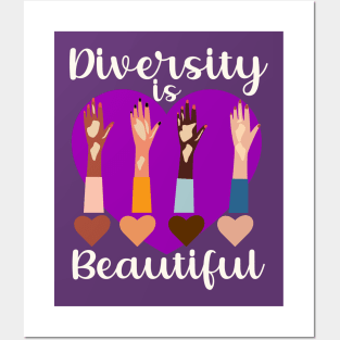 Vitiligo Awareness Diversity is Beautiful Girls Womens Posters and Art